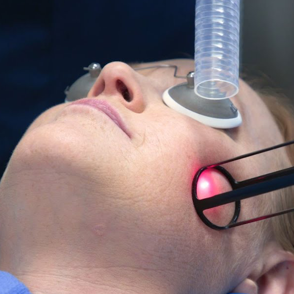 Laser Treatment